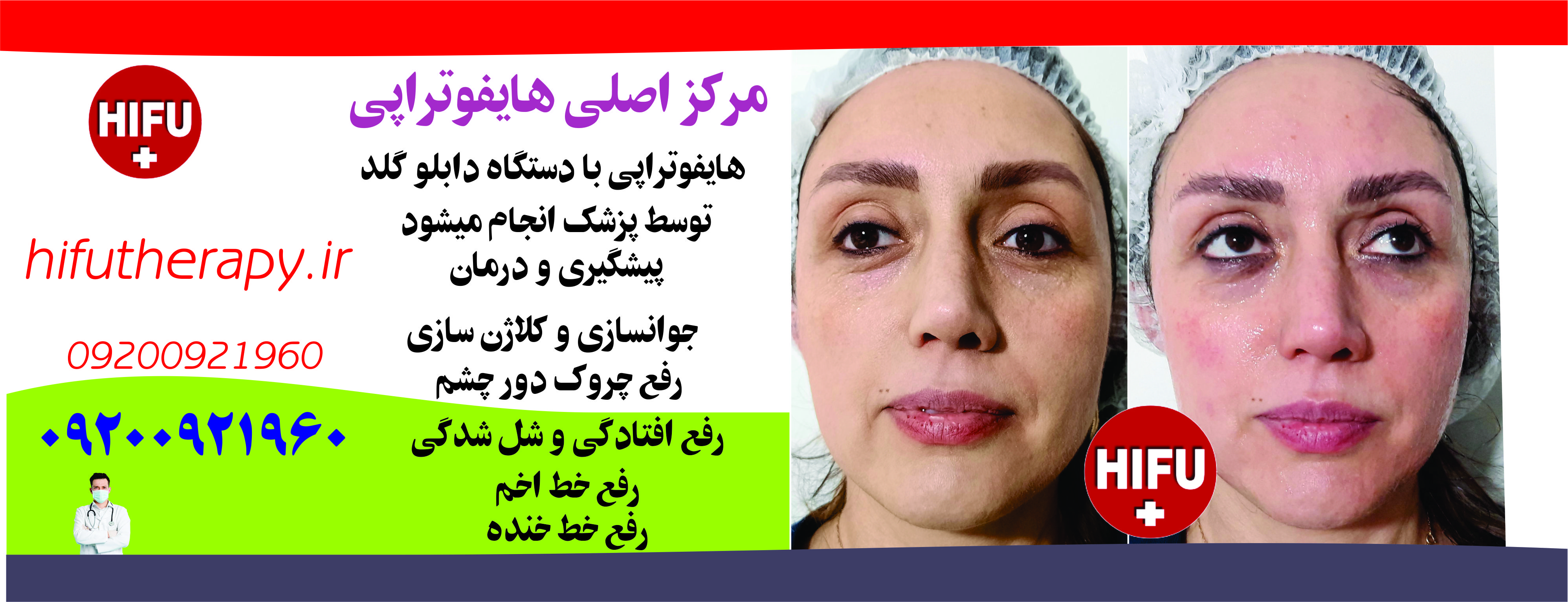 مرکز اصلی هایفوتراپی