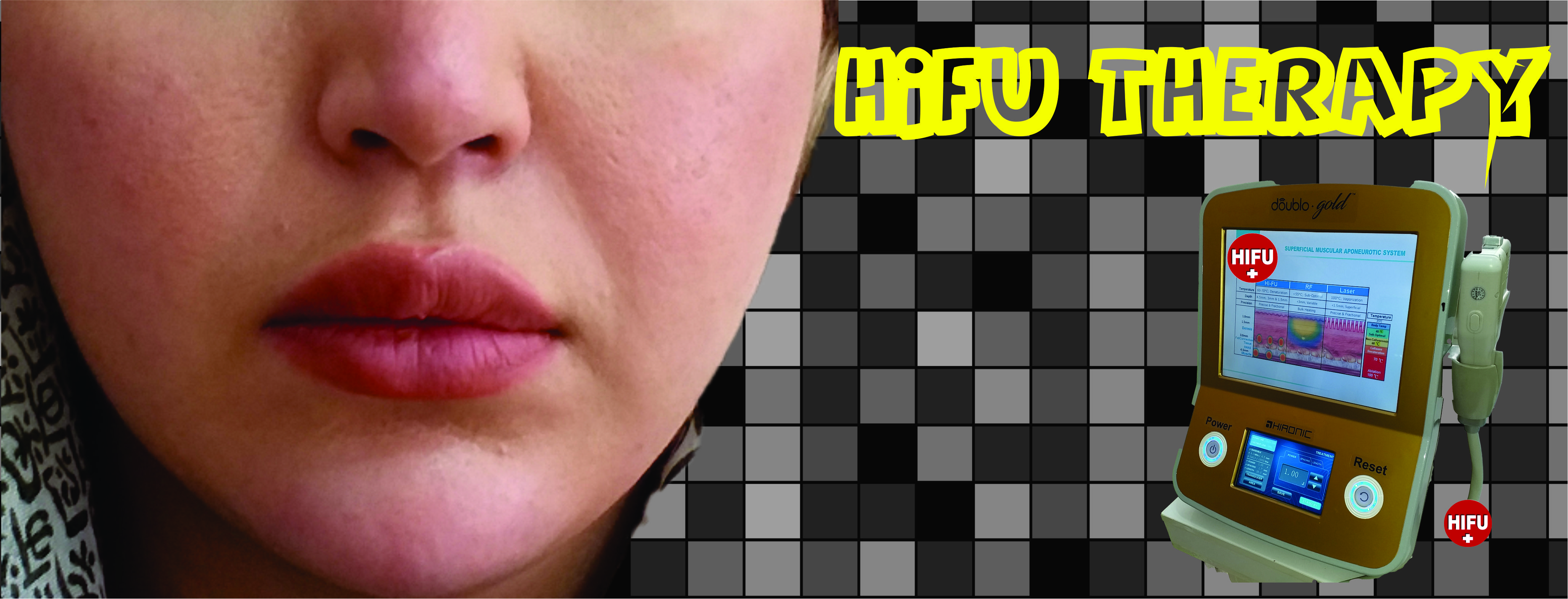 هایفوتراپی با دابلو گلد