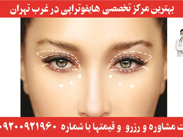 هایفوتراپی غرب تهران