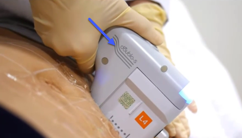 هایفوتراپی