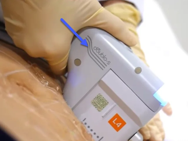 هایفوتراپی