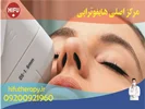 گالری تصاویر هایفوتراپی