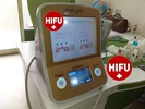 هایفوتراپی شکم
