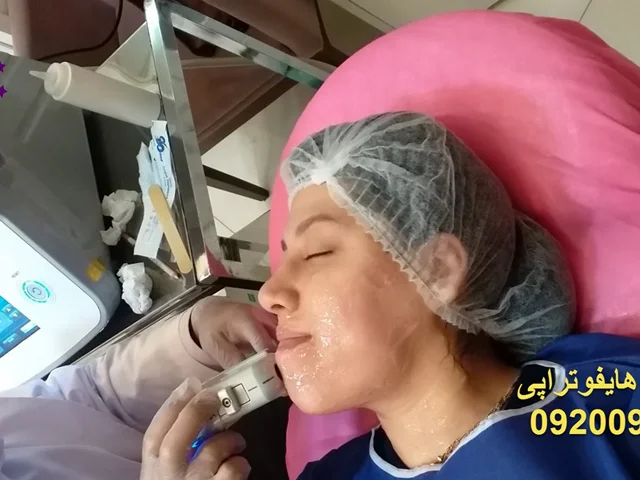 هایفوتراپی با دستگاه گلد بهترین مرکز هایفوتراپی