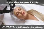 تزریق بوتاکس در تهران