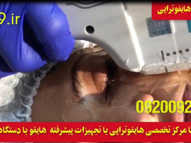 هایفوتراپی