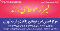 لیزر موهای زائد